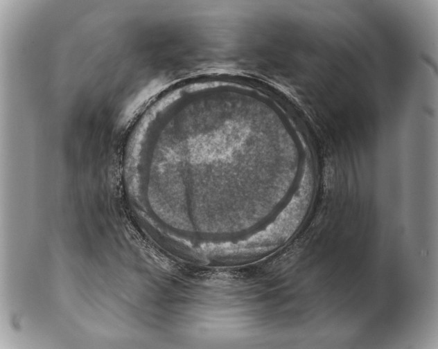 X0000101151359200807251039