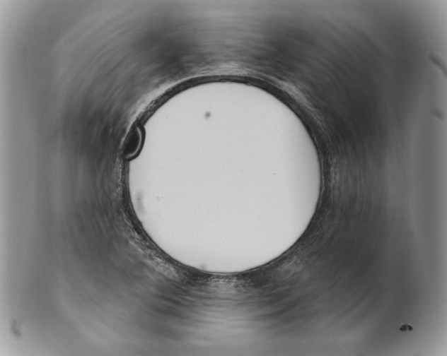 X0000101151364200807251039