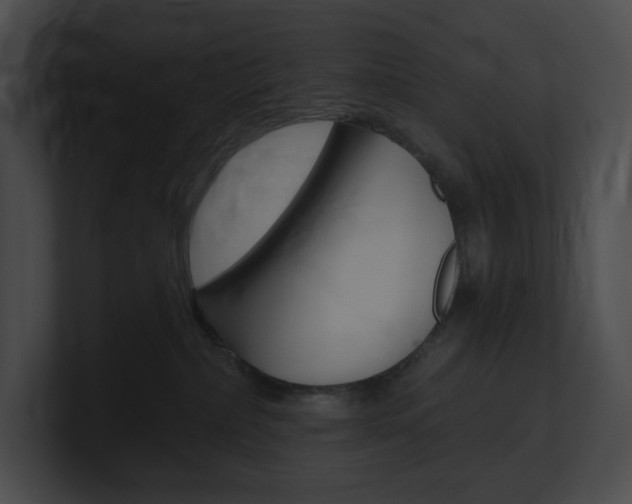 X0000101160236200806270739