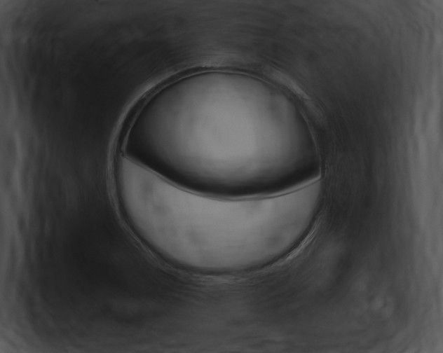 X0000101161122200806270726