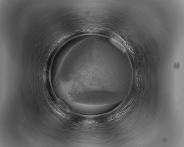 X0000101160203200806271017