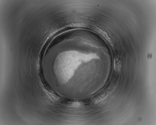 X0000101160204200806271017