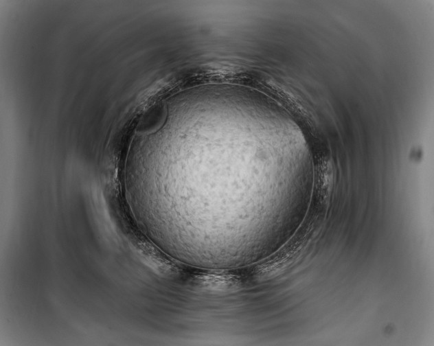 X0000101160615200806271011