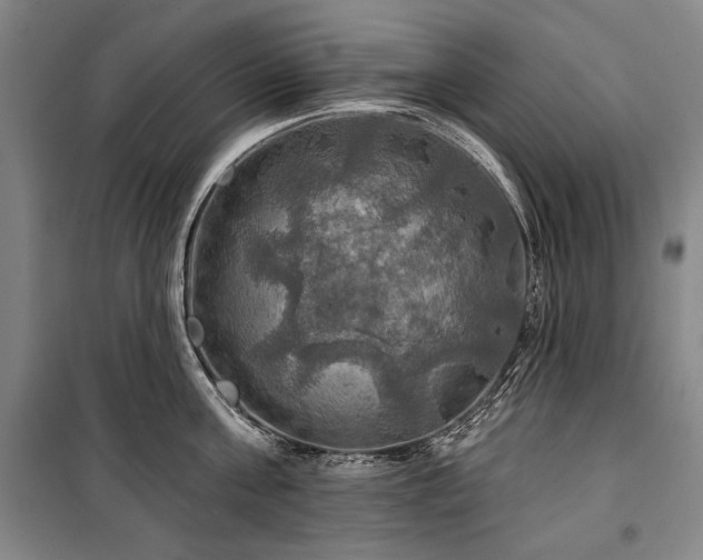X0000101160811200806271008