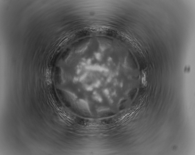 X0000101160819200806271007