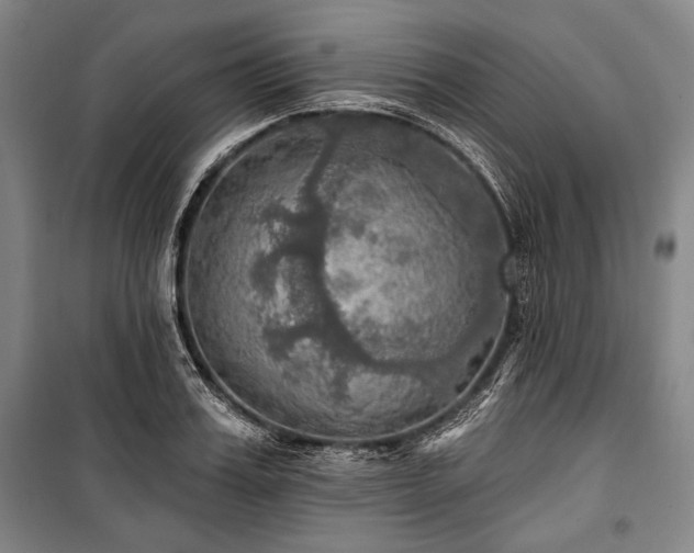 X0000101160987200806271005