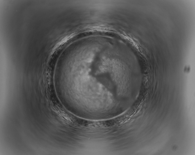 X0000101161159200806271003