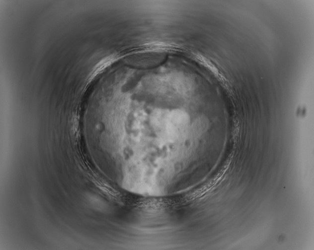 X0000101161259200806271001