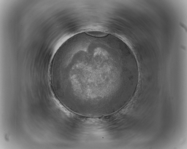 X0000101161056200807071153