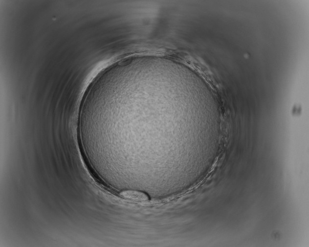 X0000101160003200807111039