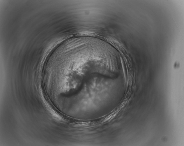 X0000101160049200807111038