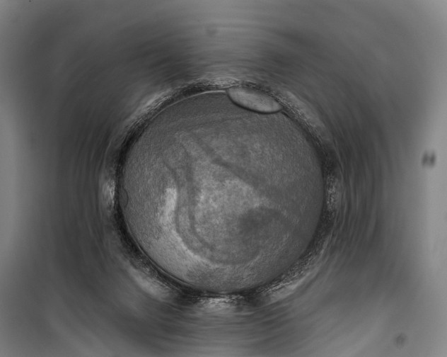 X0000101160072200807111038