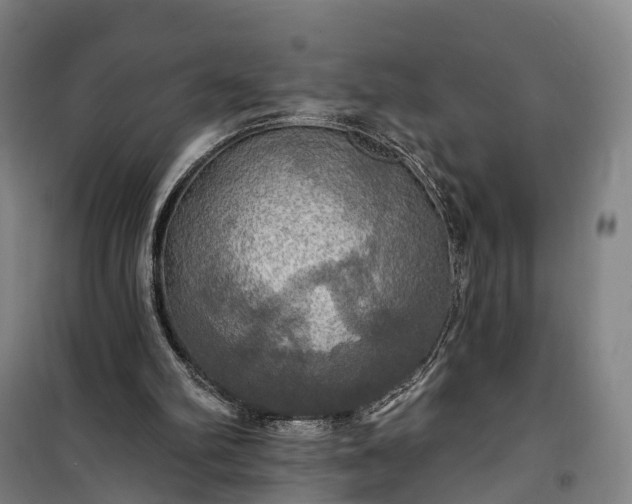 X0000101160102200807111038