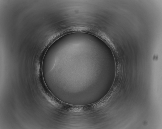 X0000101160110200807111038