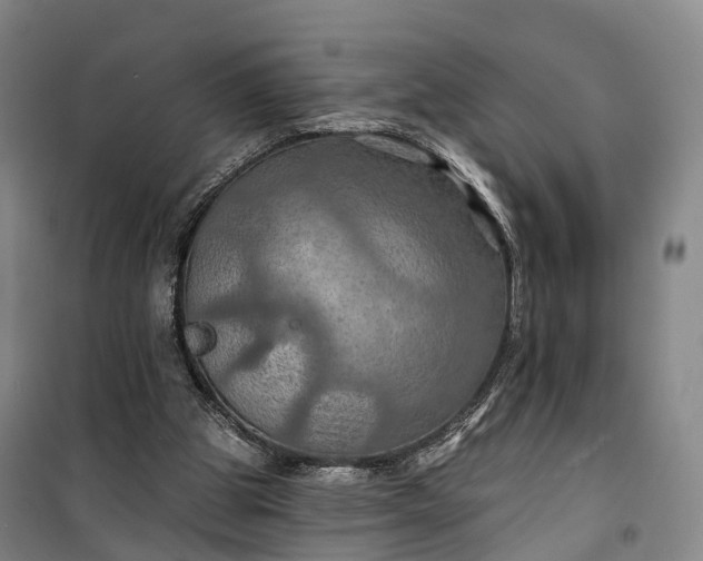 X0000101160153200807111037