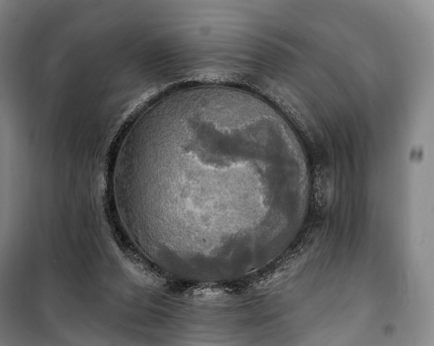 X0000101160208200807111036