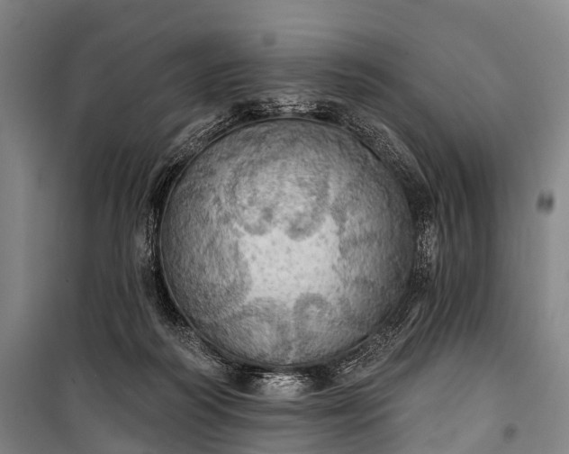 X0000101160218200807111036