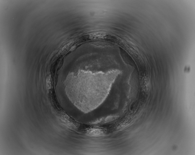 X0000101160224200807111036