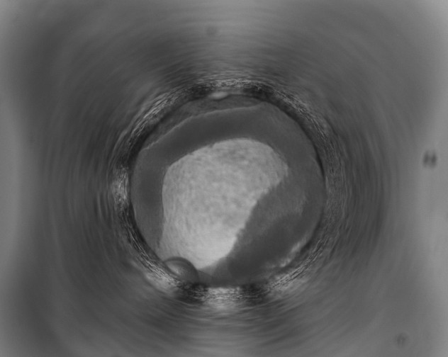 X0000101160240200807111036