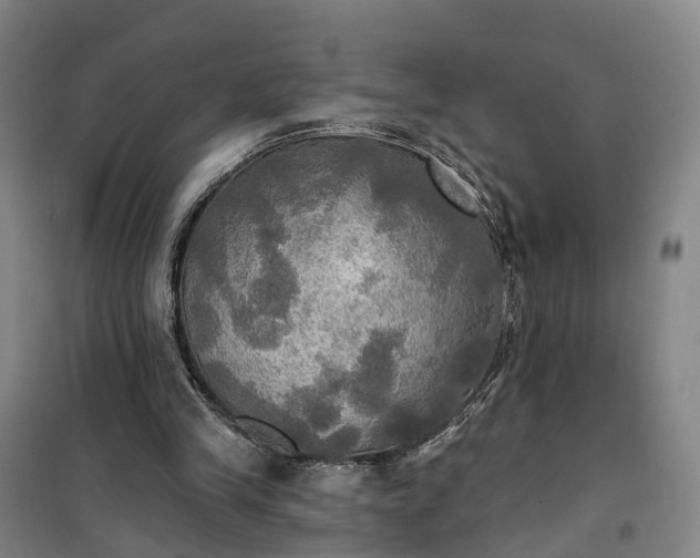 X0000101160245200807111035