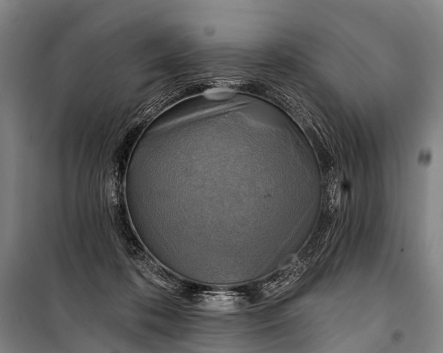 X0000101160316200807111035