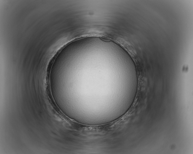 X0000101160338200807111034