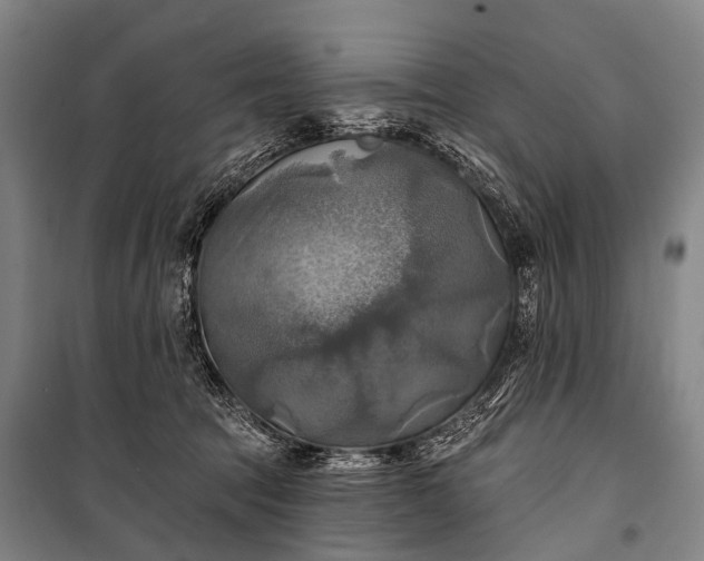 X0000101160369200807111034