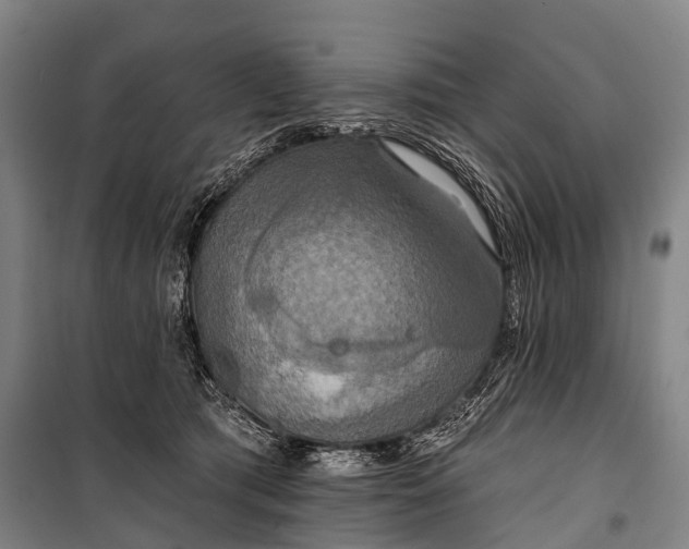 X0000101160417200807111033