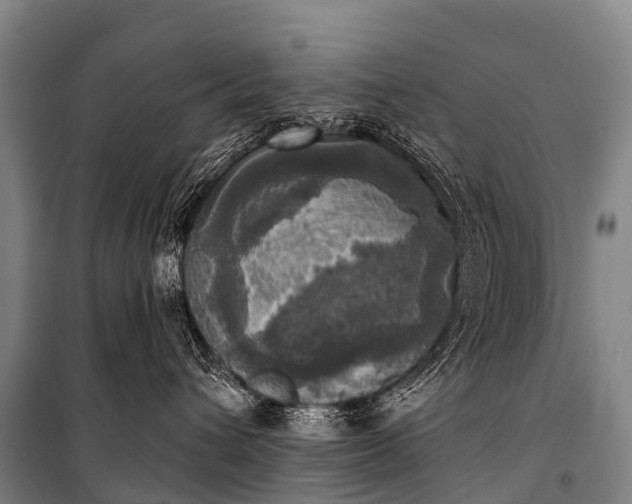 X0000101160432200807111033