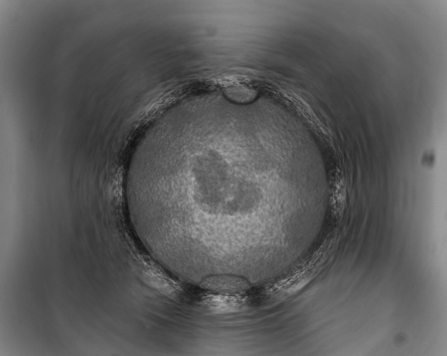 X0000101160466200807111033