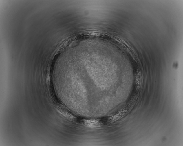 X0000101160516200807111032