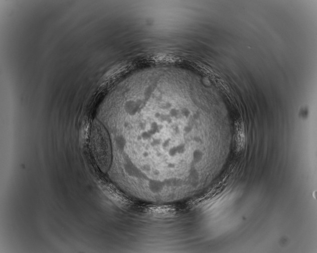 X0000101160619200807111030