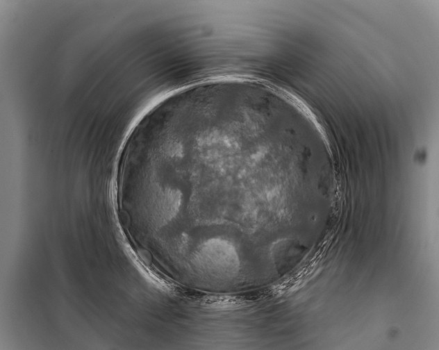 X0000101160811200807111027