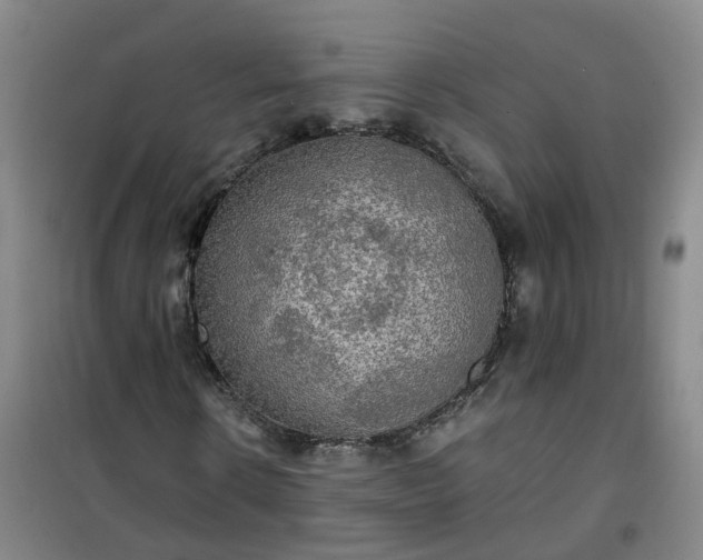 X0000101160914200807111025