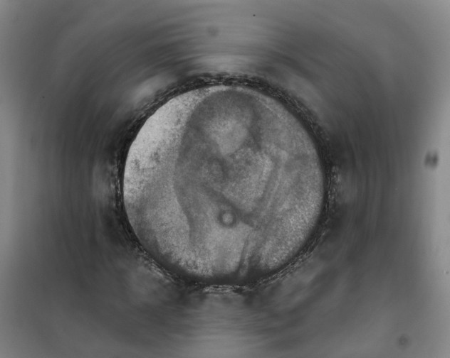 X0000101160918200807111025