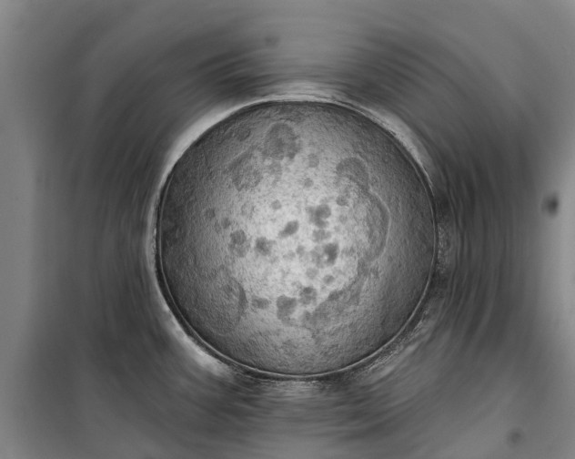 X0000101161387200807111018