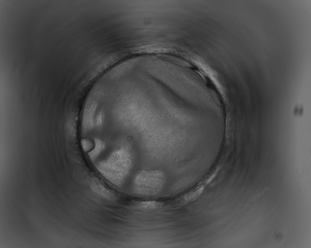 X0000101160153200807181407