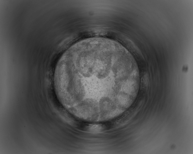 X0000101160218200807181407