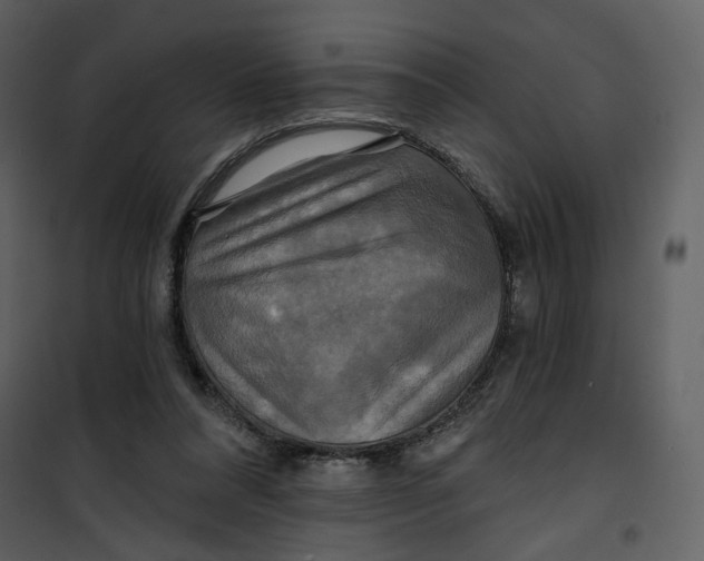 X0000101160304200807181405