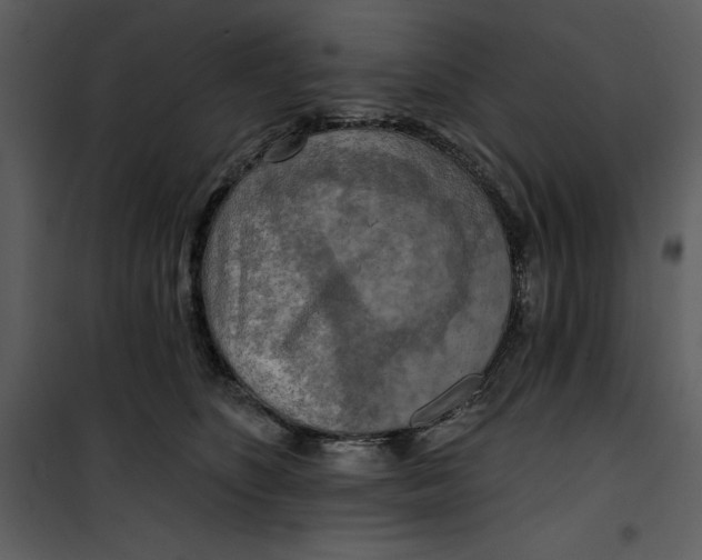 X0000101160516200807181402