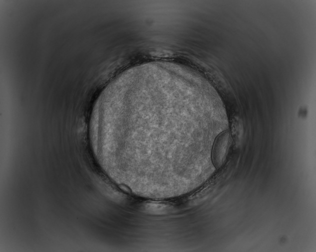X0000101160614200807181400