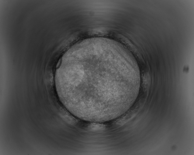 X0000101160617200807181400