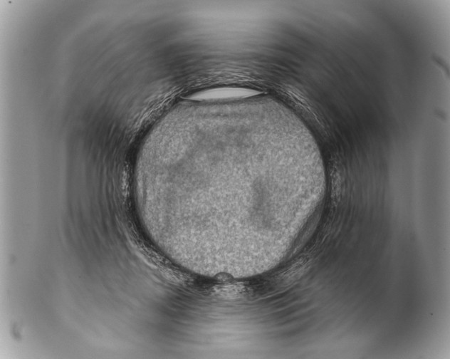 X0000101160362200807251116