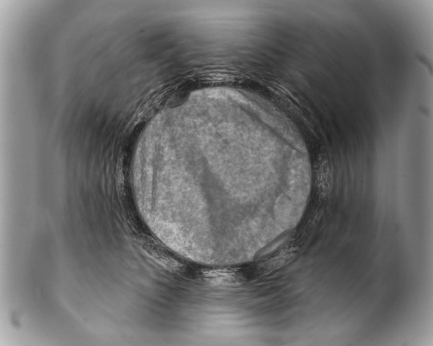 X0000101160516200807251113