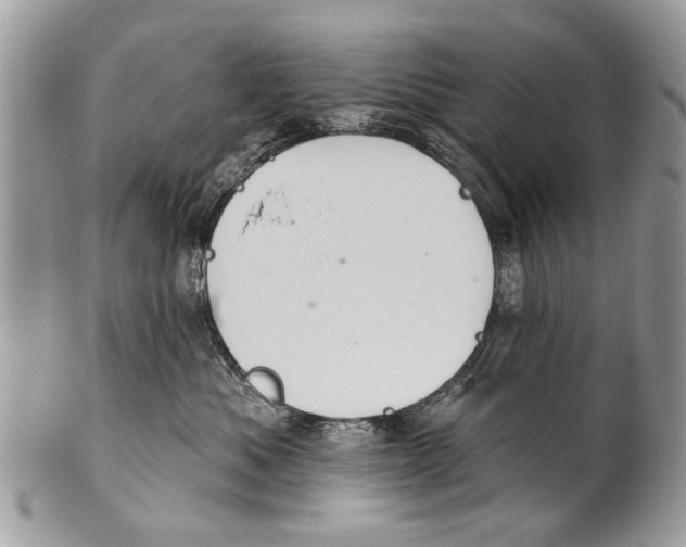X0000101160525200807251113