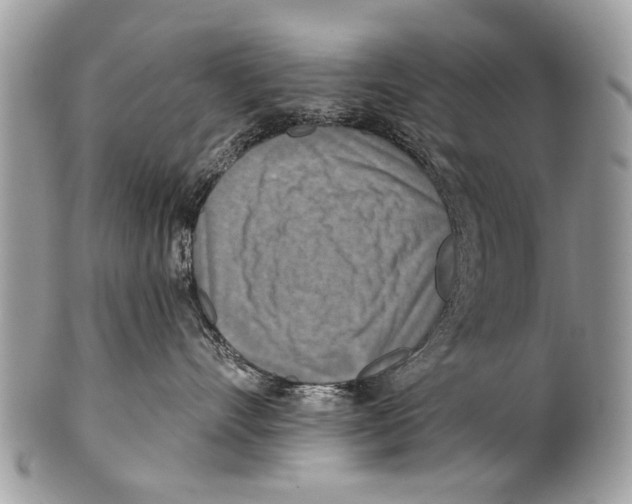 X0000101160528200807251113