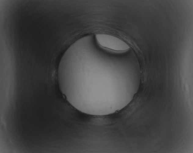 X0000101170521200806270756