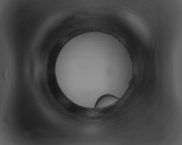 X0000101170526200806270756