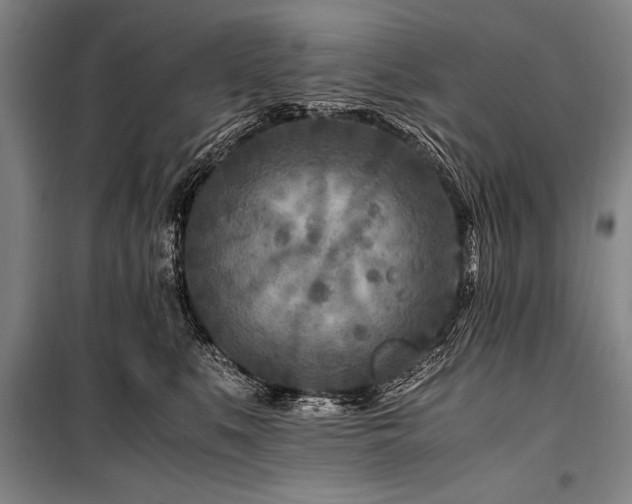 X0000101170519200806271037
