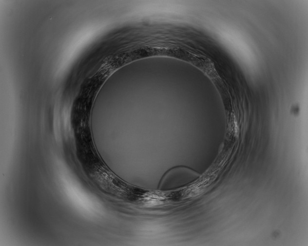 X0000101170526200806271037